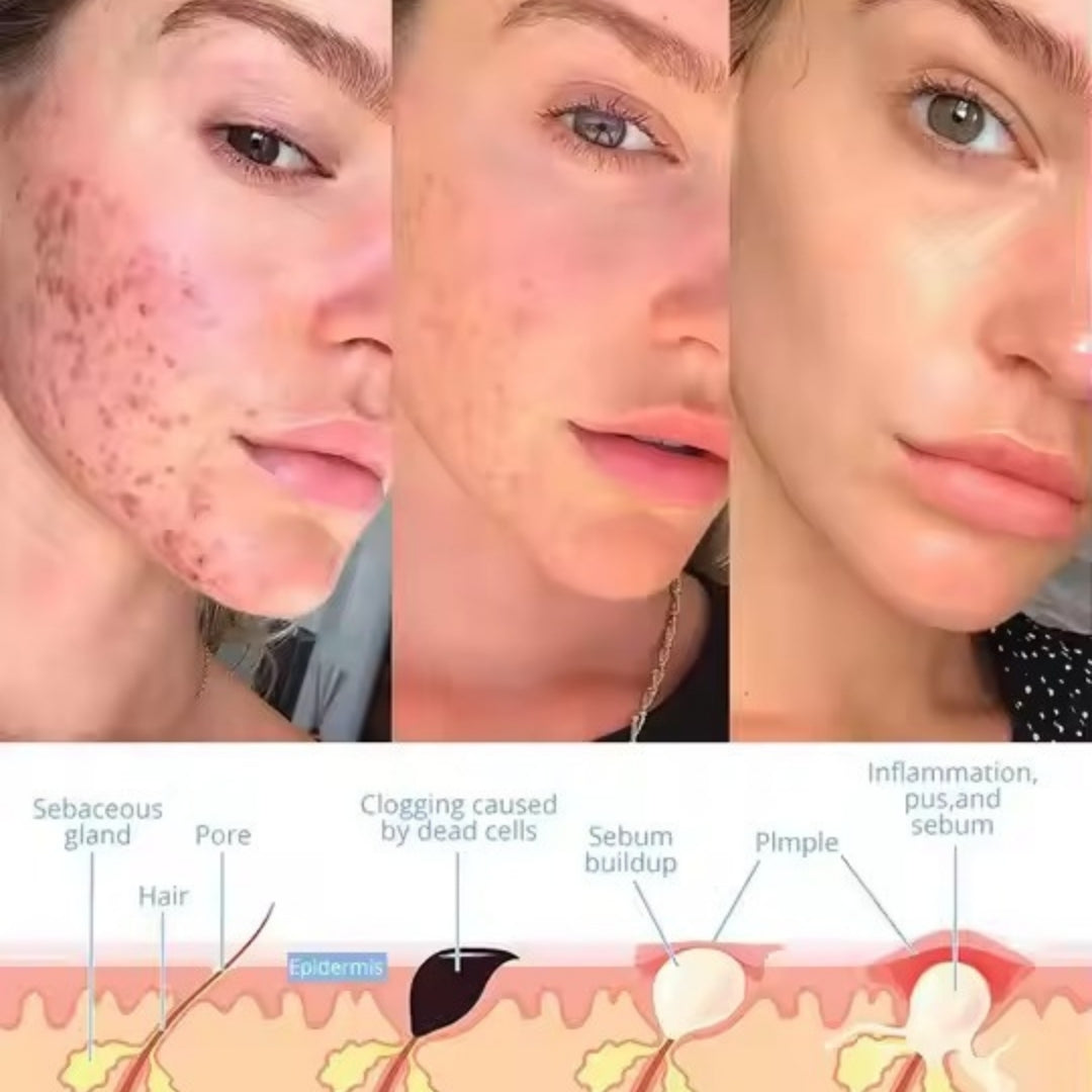 Skinova™ - Facial Wand