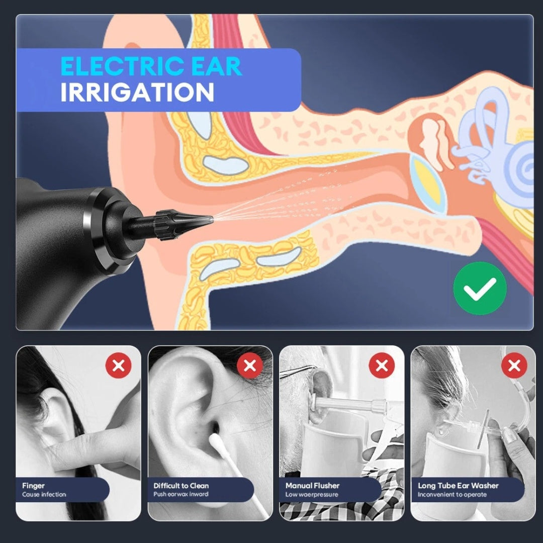 QuietWax™  - Ear Wax Remover
