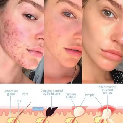 Skinova™ - Facial Wand